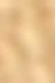 MiX gold