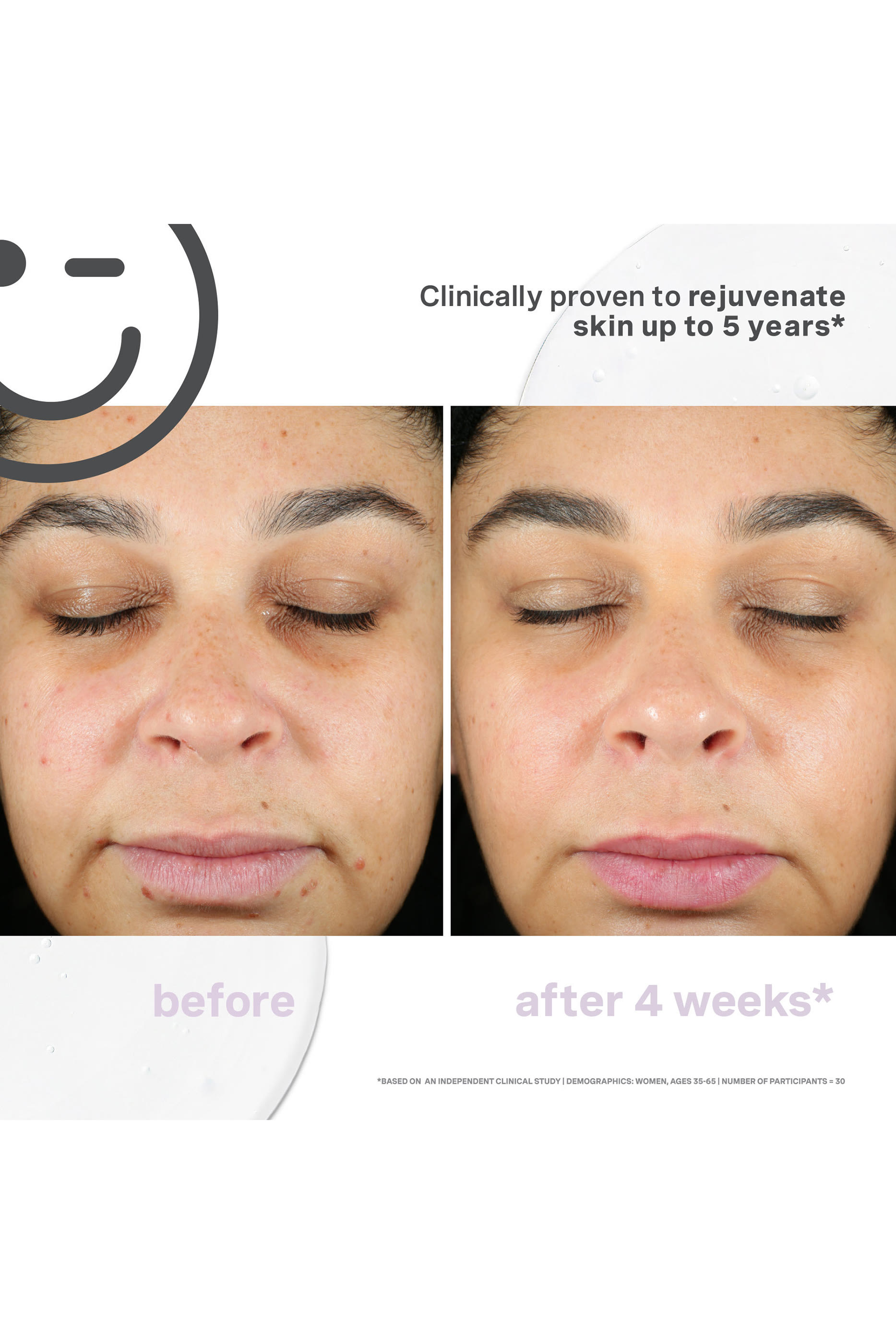 سيروم كيتسيوتيكالز سوبرسيل لتجديد البشرة