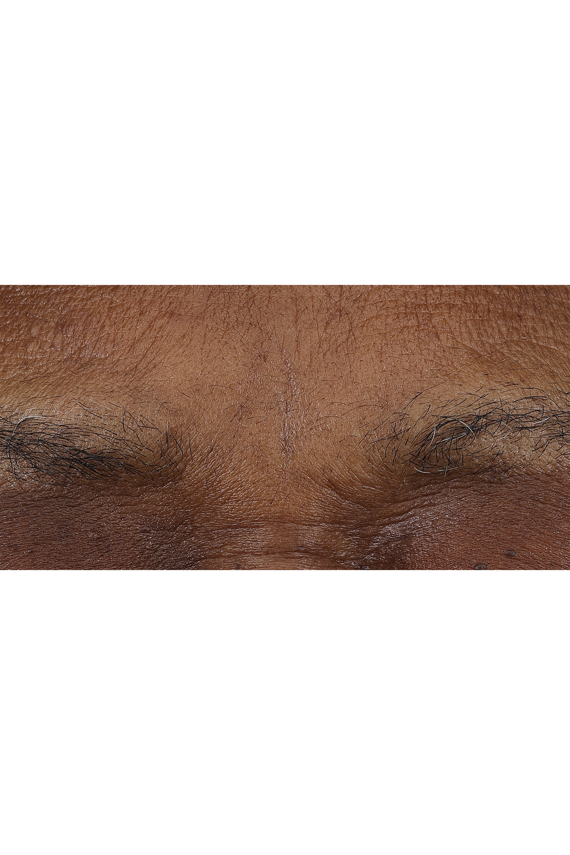 مرطب نهري وليلي سمارت كلينيكال ريبير بالريتينويد