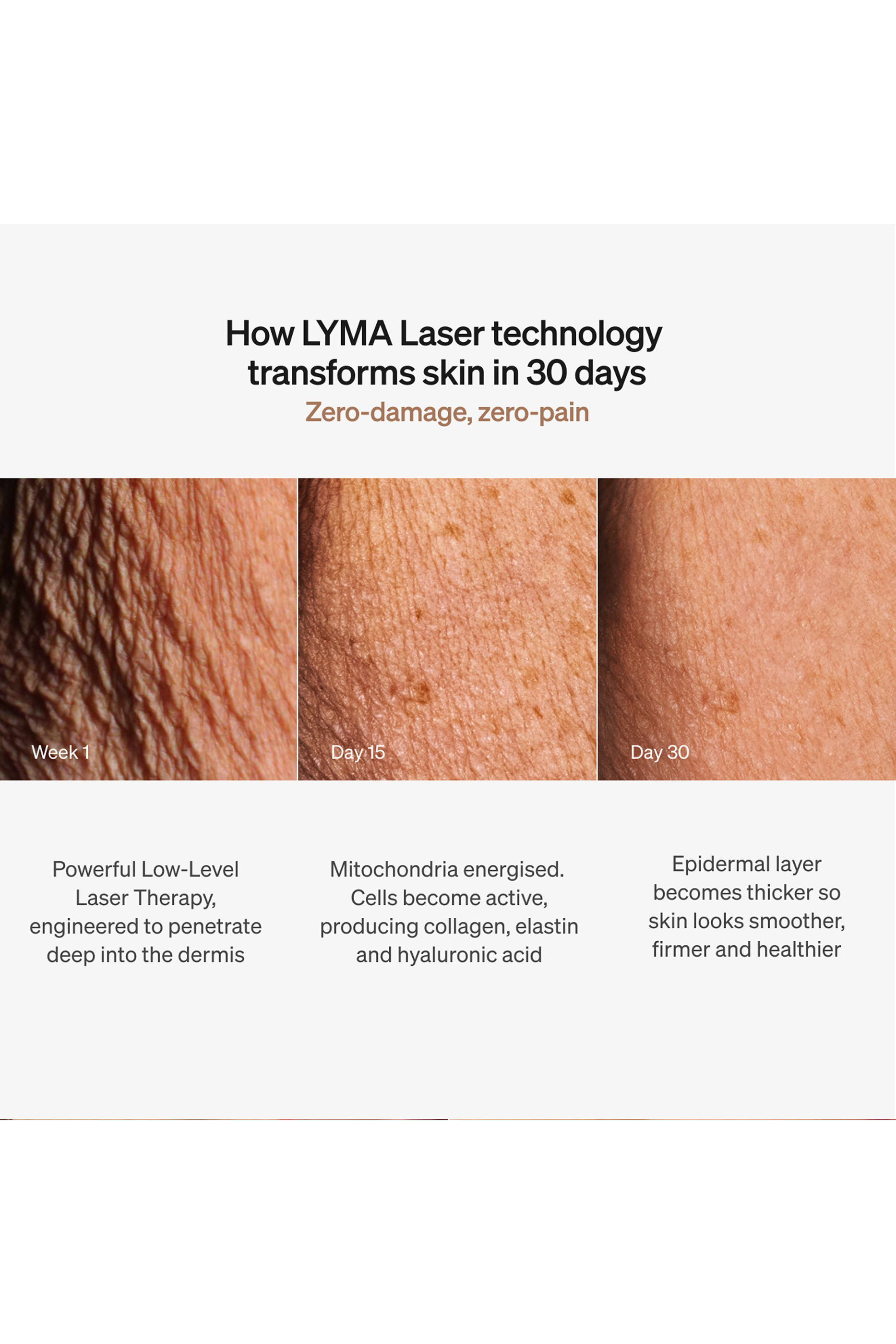 مجموعة بتقنية الليزر للمبتدئين