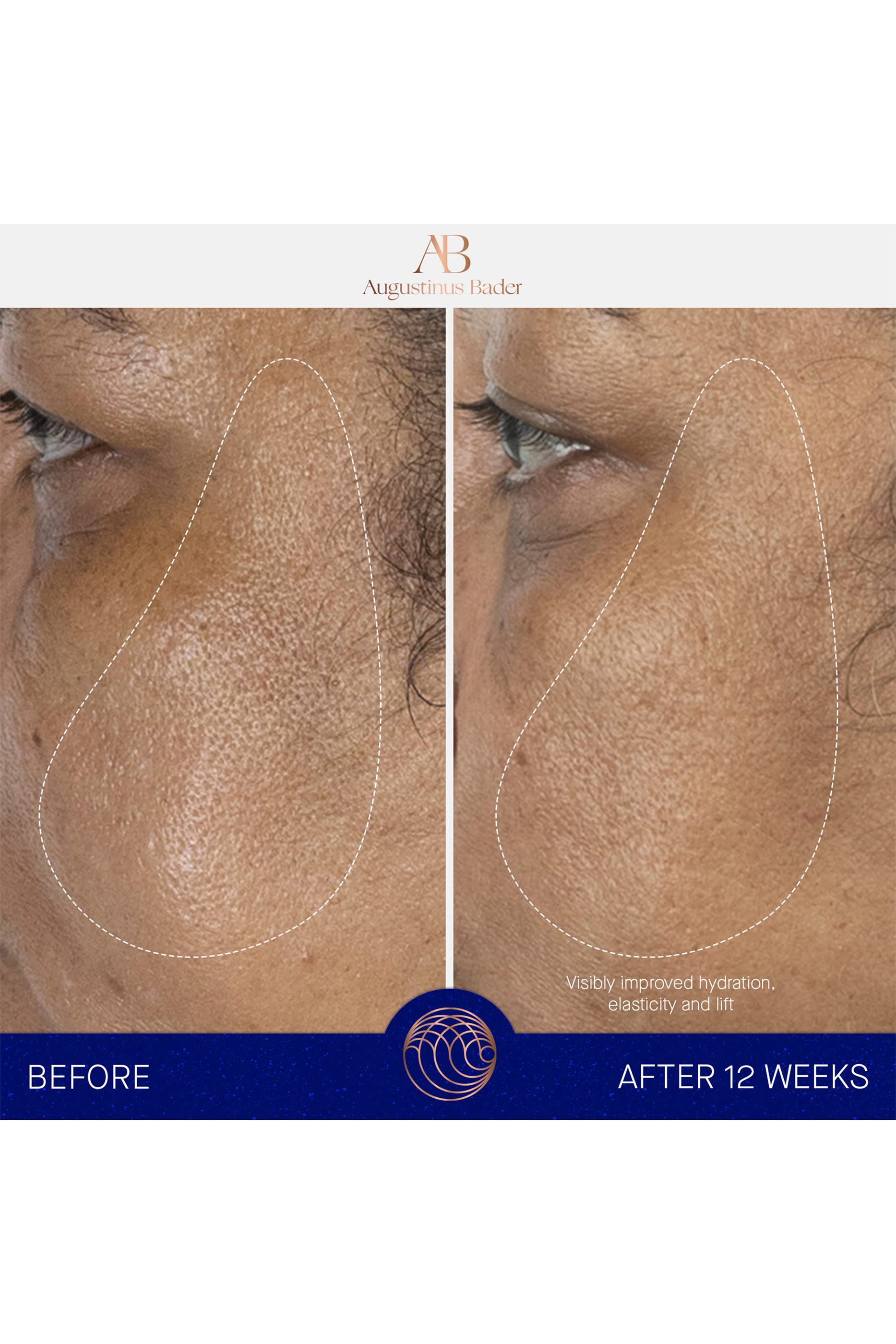 سيروم ذا سيروم