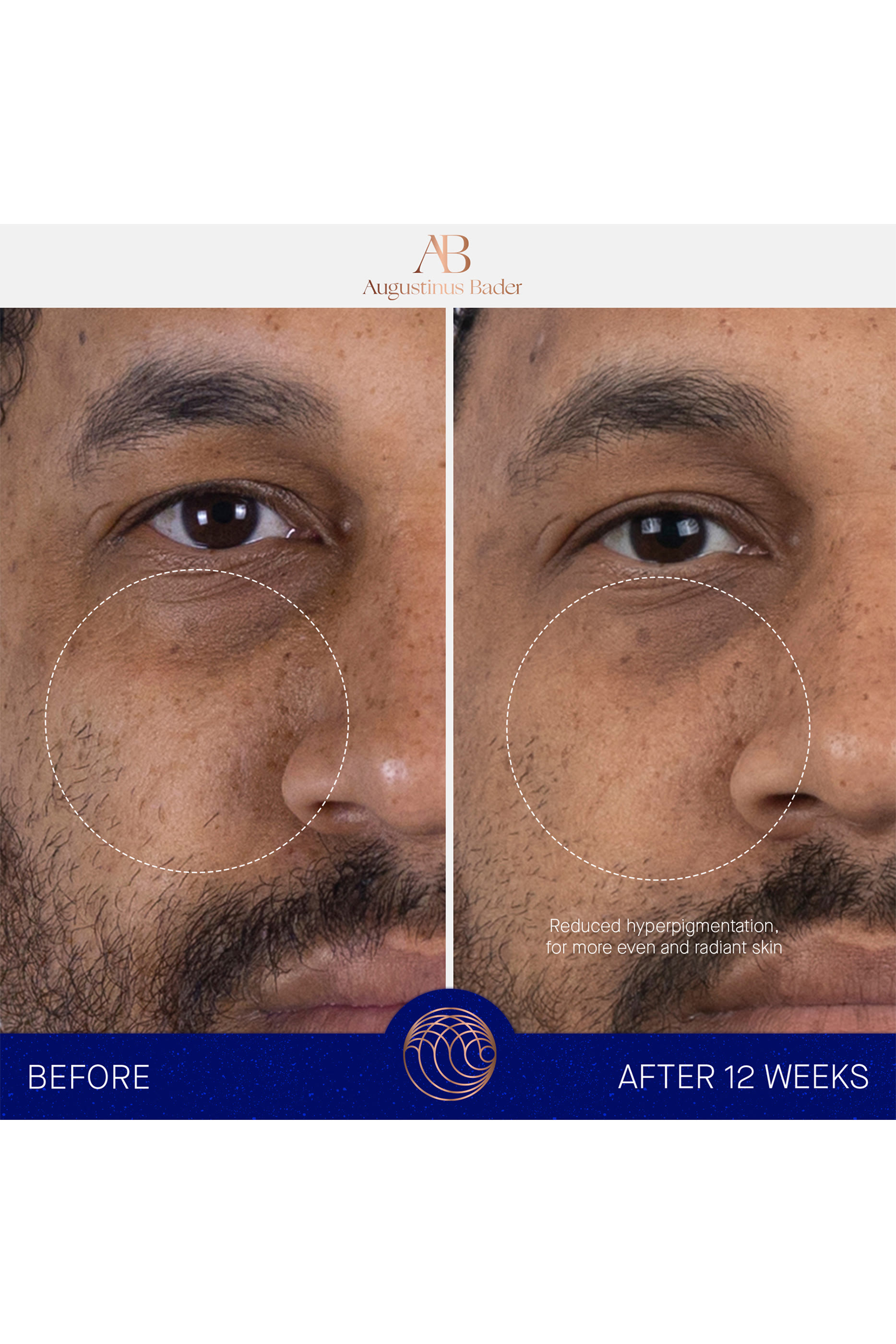 سيروم ذا سيروم