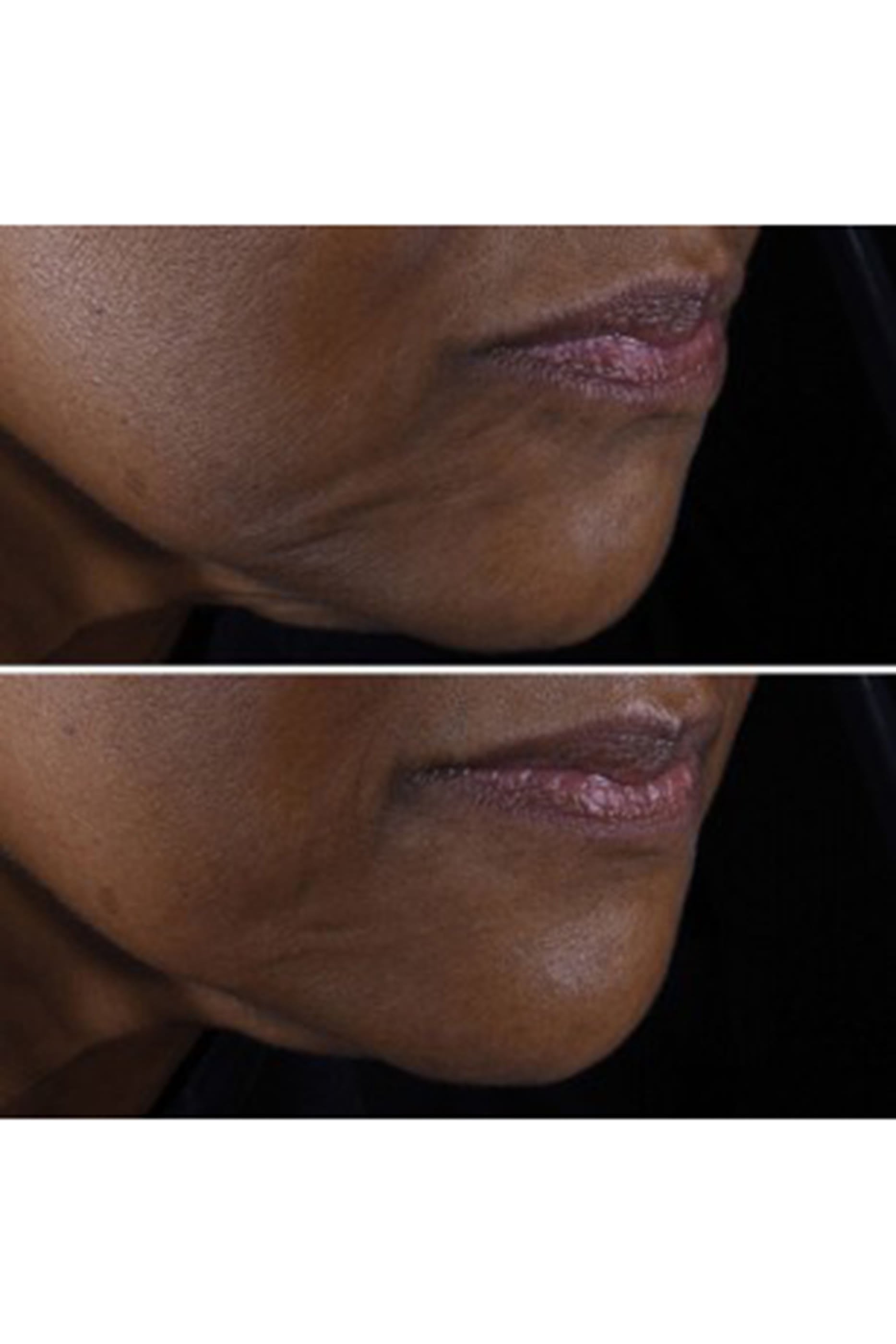 مجموعة سمارت كلينيكال ريبير لإصلاح الخطوط والتجاعيد، توفير 32‏‏‏%